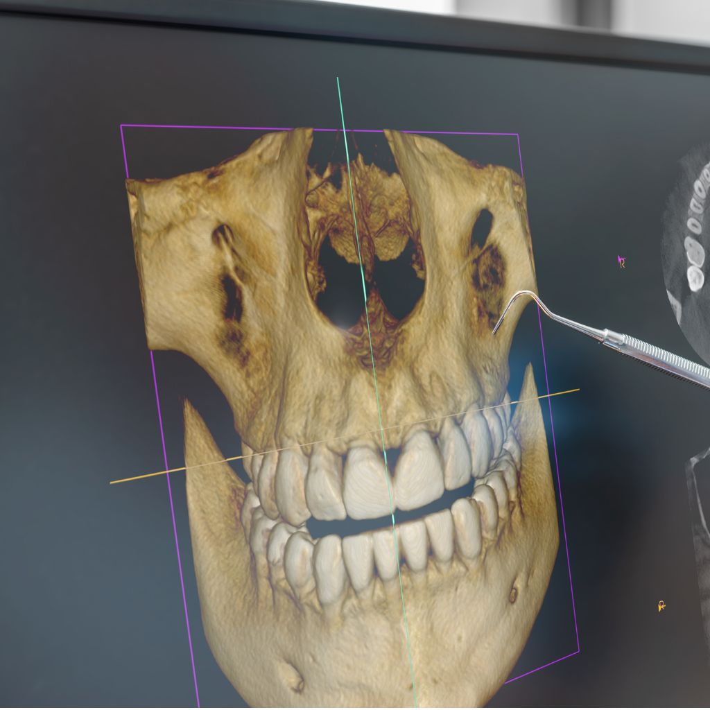 dental 3d imaging